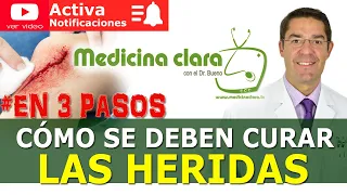 CURAR HERIDAS 🩸 3 PASOS SENCILLOS 👨‍⚕️ ¿Dejar herida tapada o al aire? | Medicina Clara