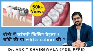 Silver Amalgam vs Composite Filling l चांदी या Composite कौन सा है बेहतर? Tooth Filling Material