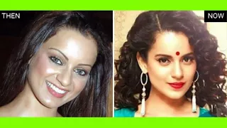 17 Bollywood Actresses before and after plastic surgery shocking unseen pics