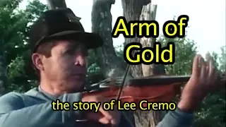 ARM OF GOLD
