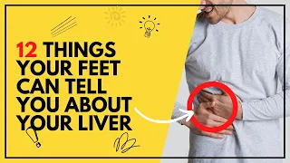 12 Things Your Feet Can Tell You about Your Liver in 2023