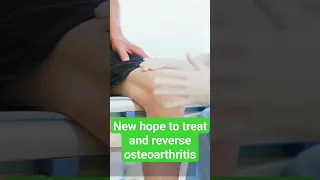 Miraculous breakthrough: Reversing osteoarthritis revealed