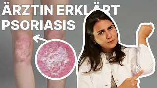 Ist Schuppenflechte/Psoriasis nur trockene Haut? 🤔 Ärztin erklärt!