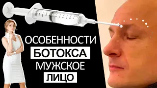 Особенности ботокса Мужское лицо