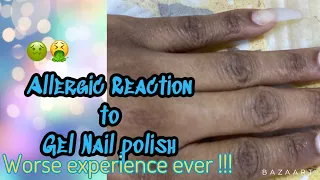 ALLERGIC REACTION TO GEL NAIL POLISH 👀 !!#alergic #gelnails #itchy #nails