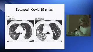 Дереш. Наслідки COVID-19 в легенях.