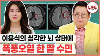 [#건강면세점] 다이어트만 신경 쓰던 이용식이 아무도 모르게 뇌경색 겪은 후 알게 된 충격적인 후유증 (TV CHOSUN 210523 방송)