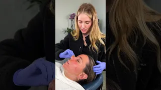 VI Peel for Acne & Acne Scarring with Nurse Lauren