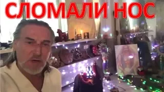 После разбирательств с наследством Никита Джигурда сломал нос.  Что там случилось? (05.11.2017)