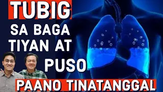 Tubig sa Baga, Tiyan at Puso. Paano Tinatanggal - Payo ni Dr Alvin Francisco at Doc Willie Ong #1333