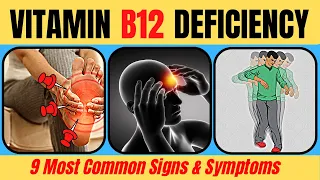 Don't Ignore These Signs: The Top 9 Symptoms of Vitamin B12 Deficiency| Doc Cherry