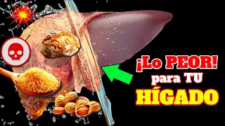 ¡ALERTA! Esto DESTRUYE tu HÍGADO sin que lo SEPAS| Los PEORES alimentos TÓXICOS para el HÍGADO