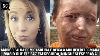 Marido falha com gasolina e deixa a mulher deformada. Mas o que ele faz em seguida, ninguém esperava