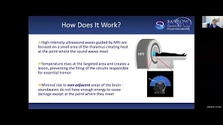 Focused Ultrasound for Essential Tremor and Tremor-Dominant Parkinson's Disease