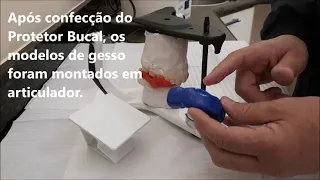 Confecção de Protetor Bucal - da obtenção do plano oclusal até instalação, com Dr Luiz Carvalho.
