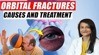 Treatment For Eye Injury | What To Do After Eye Injury ? | Vision Eye Centre