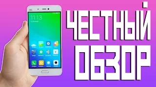 ЧЕСТНЫЙ ОБЗОР Xiaomi Mi5