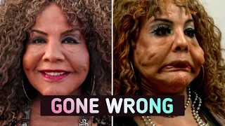 These Illegal Plastic Surgeries Ruined Their Lives