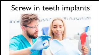 Screw in teeth implants-and where to get them..