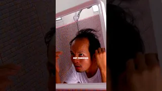 Revive hairline with secret cayenne ingredient [4/100 Hair Loss]