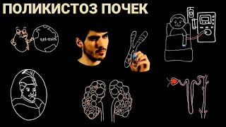 Поликистоз почек ►12 месяцев #8