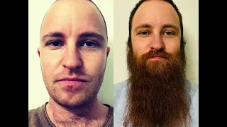 YEARD CHALLENGE 2022 - Growing a beard in 1 year