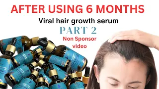 PILGRIM HAIR GROWTH SERUM| PART 2| PILGRIM Redensyl & Anagain hair serum #hairgrowth