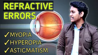 refractive errors of eye ||myopia ||hyperopia ||astigmatism ||emmetropia ||ametropia | 2021