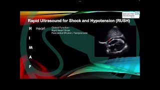 Resuscitation Ultrasound Protocols in Shock / Dr I Yonis