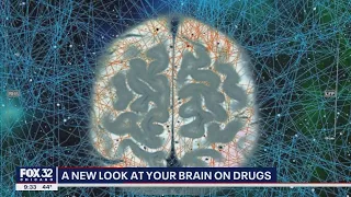 Chicago researchers lay out more detailed picture of what drugs do to our brains