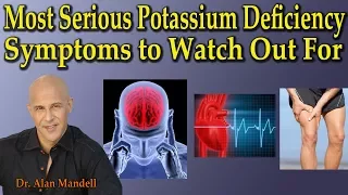 3 Most Serious Potassium Deficiency Symptoms to Watch Out For - Dr Alan Mandell, D.C.