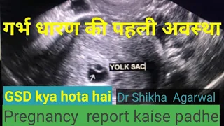 Gestational  sac GS/how to read pregnancy  report /yolk sac/ doctor home