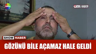 Göz seğirmesi kabusu oldu!