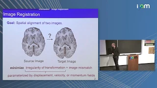 Marc Niethammer: "Deep Learning for Medical Image Registration"