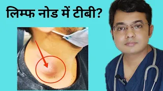 TB in Lymph node in Hindi |लिम्फ नोड में टीबी?