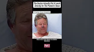 [Part 1] The Doctor Actually Put A Leech Directly On The Patient's Nose #shorts