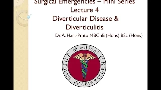 Surgical Emergencies –  Lecture 4 – Diverticular Disease & Diverticulitis