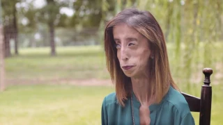 Wonderfully Made | HerStory: Lizzie Velasquez