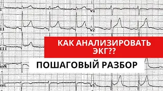 Анализ ЭКГ. Пошаговый разбор.