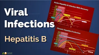 Viral Infections- Hepatitis B (English subtitle/中文字幕)