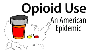 Opioid Use: An American Epidemic