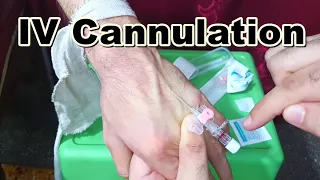 How to Insert IV Cannula | IV Cannulation Technique | Branula | Intravenous Catheter