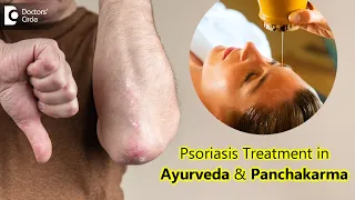 Role of Panchakarma in treating Psoriasis - Dr. Chaithanya K S | Doctors' Circle