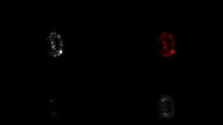 Serial two-photon Tomography