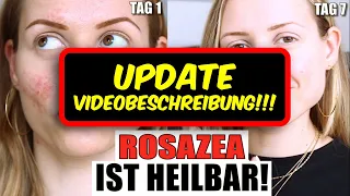 Rosazea HEILMITTEL gefunden! (SIEHE VIDEOBESCHREIBUNG!) NICHT Soolantra | NICHT Retinol  »Lalalunia«