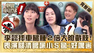 自己當醫生小心芭比Ｑ！李懿摔車腿腫「２倍大」險截肢！表演「腳清眼屎」小Ｓ驚：好厲害！【#小姐不熙娣】20230622 完整版 EP331