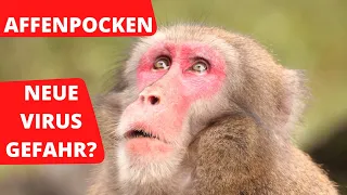Affenpocken - neue Virus Gefahr?