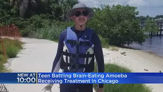 Florida teen suffering from brain-eating amoeba begins treatment in Chicago