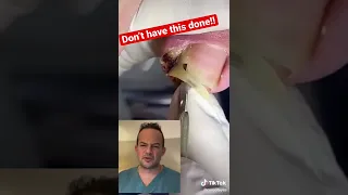 EXTREME INGROWN TOENAIL FROM A PEDICURE! 😱 #shorts # reaction