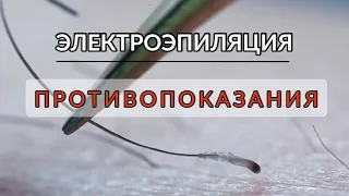 Электроэпиляция - Противопоказания / Electrolysis